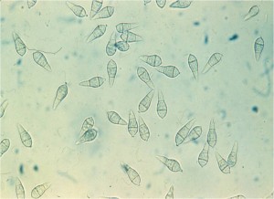 Pyricularia-conidia-PD-300x218